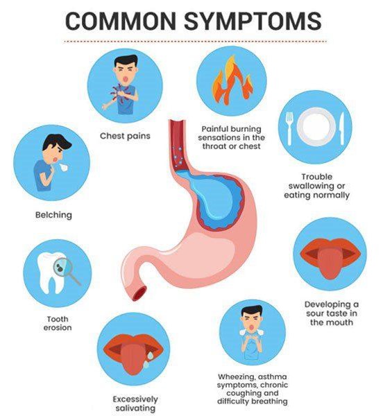 can you have gerd and not know it understanding silent symptoms and risks