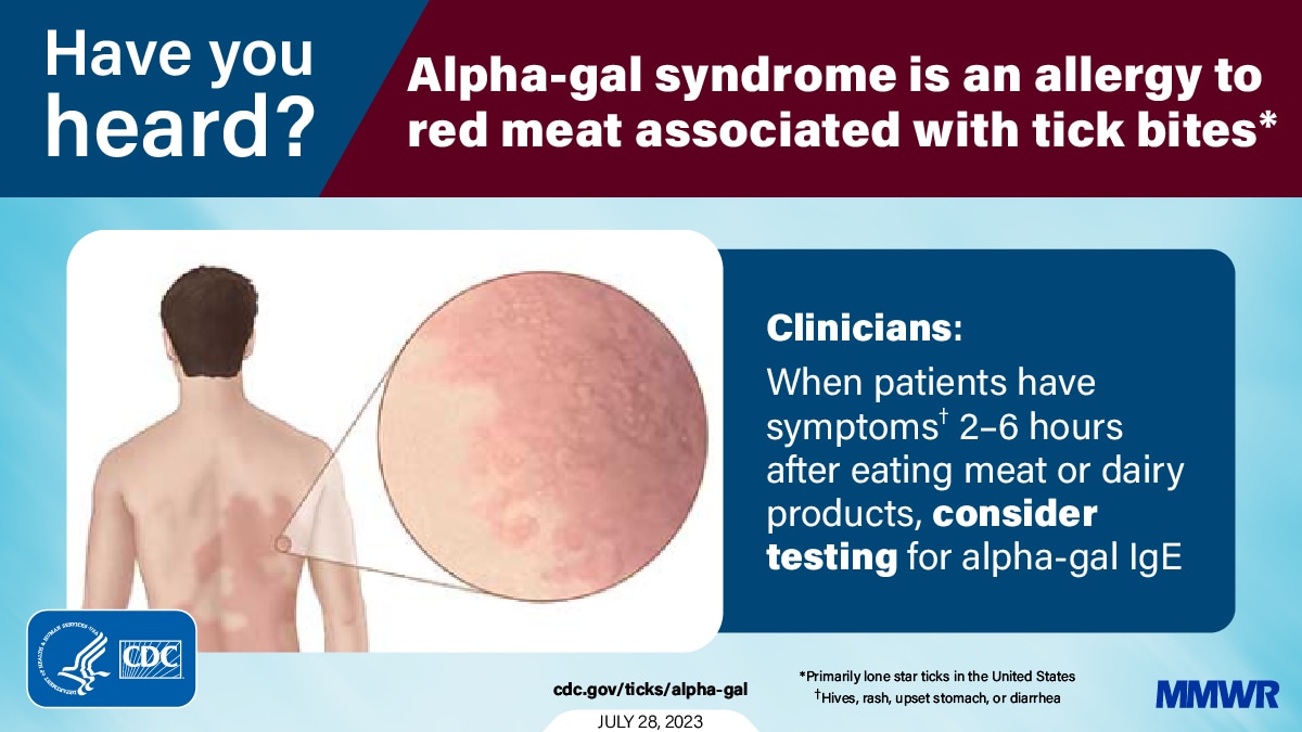 how long does alpha gal syndrome last understanding symptoms and duration