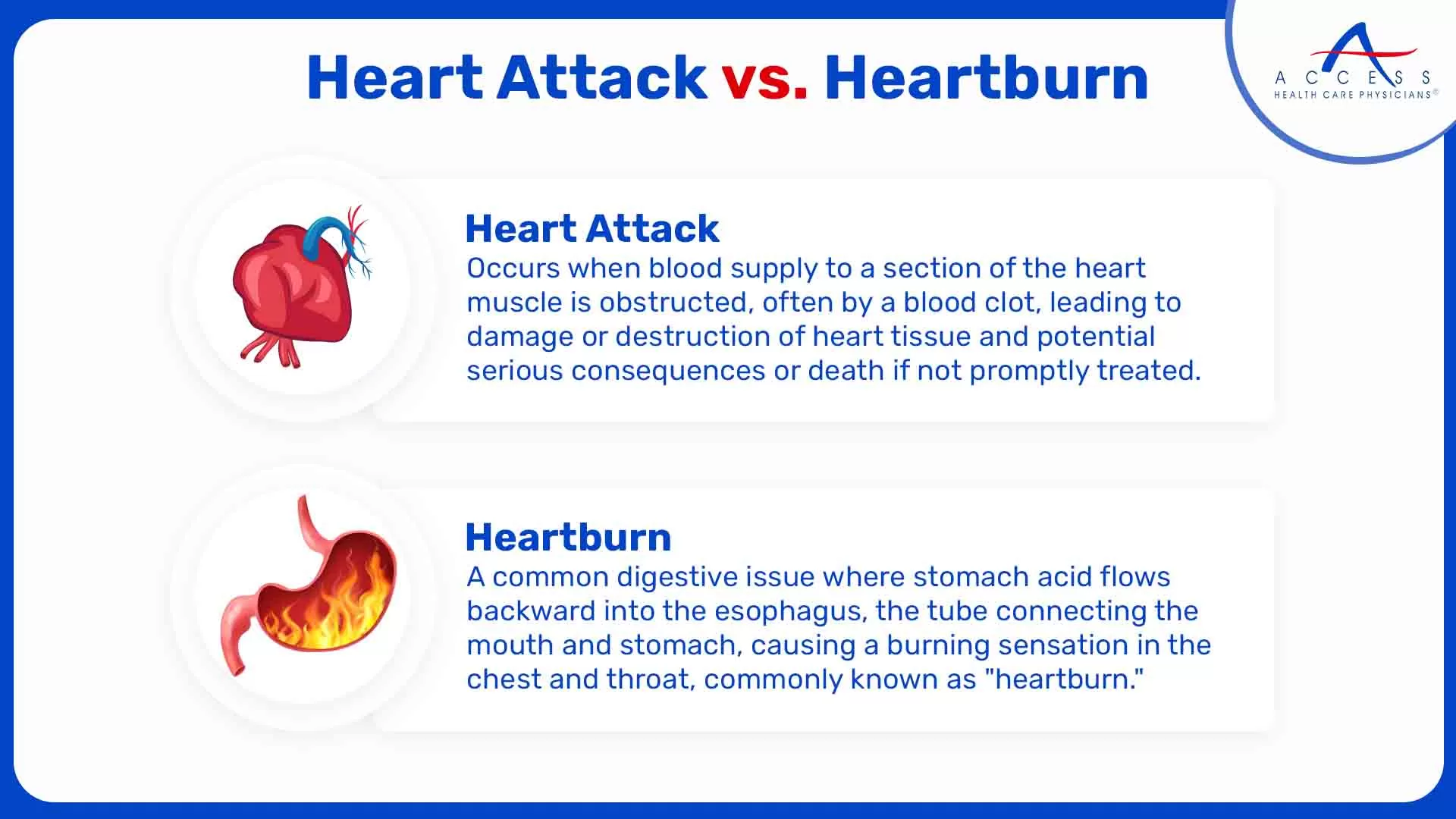 is heartburn a sign of heart problems understanding the connection