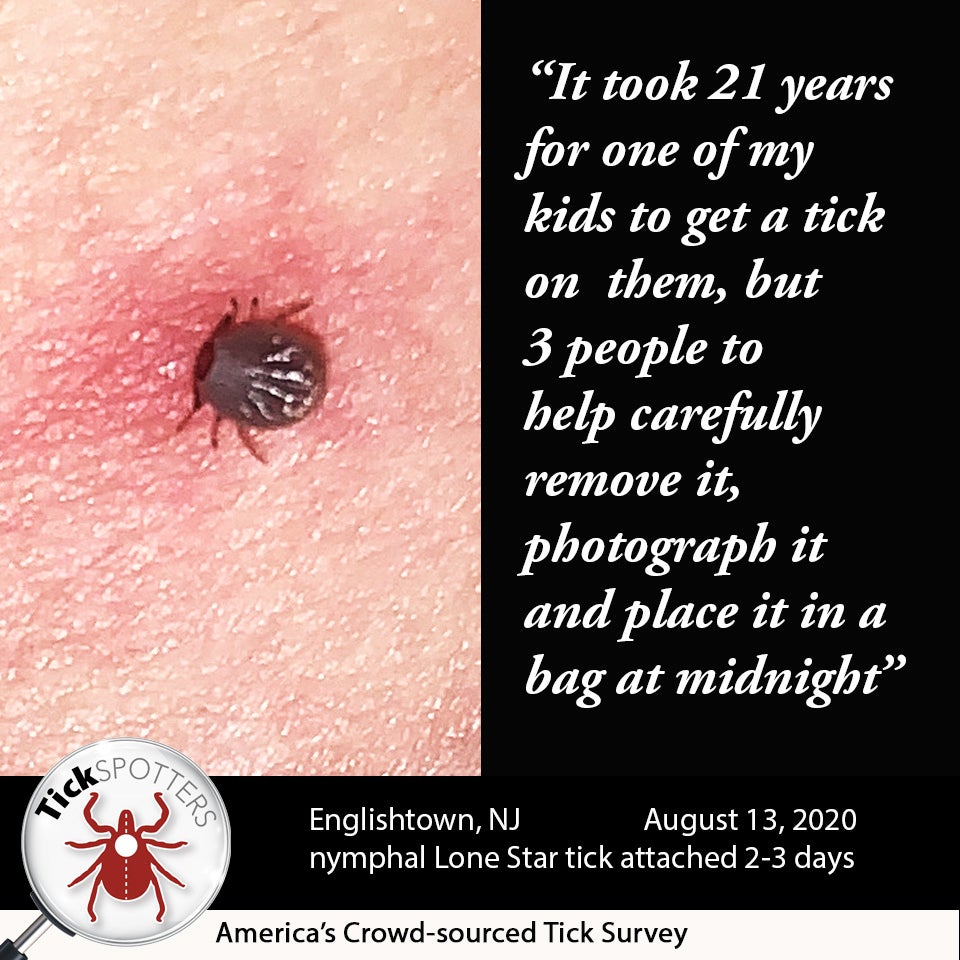 understanding the symptoms of a lone star tick bite what you need to know