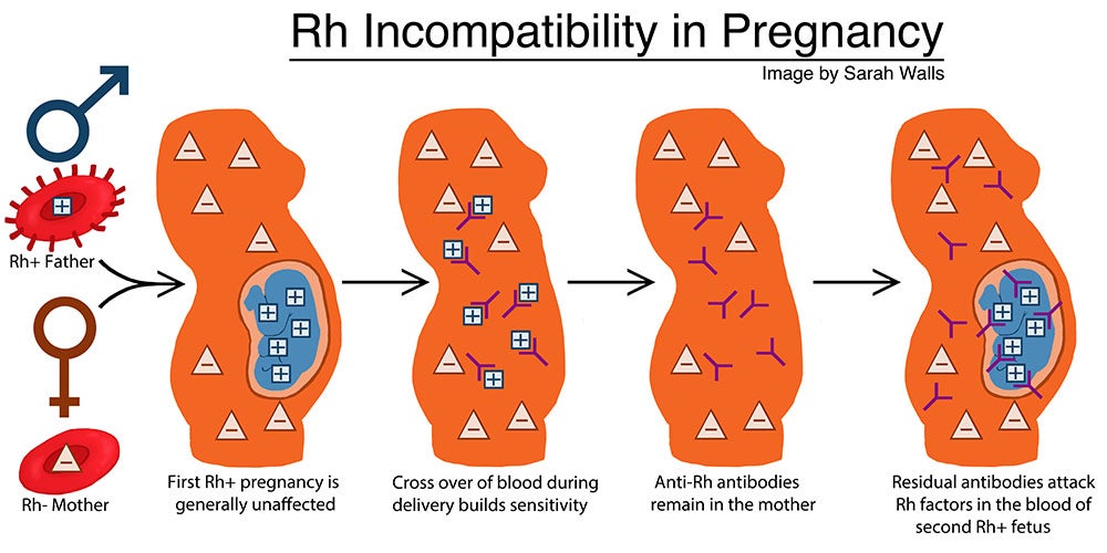 what does mean in blood type understanding rh factor